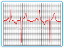 ECG Reports