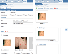 EMR - MOHS Procedures